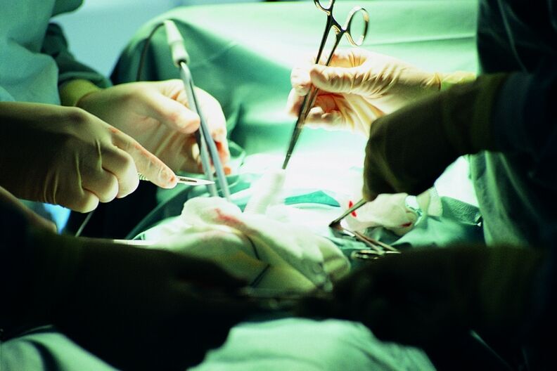 ķirurģiska dzimumlocekļa biezuma palielināšana